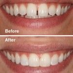 Cosmetic Dentistry in San Antonio Dr. Precious Thomson. Thousand Oaks Dental. General, Cosmetic, Restorative, Preventative, Pediatric, Family Dentistry. Dentist in San Antonio Texas 78232