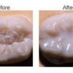 Preventative Dentistry in San Antonio, TX Dr. Precious Thomson. Thousand Oaks Dental. General, Cosmetic, Restorative, Preventative, Pediatric, Family Dentistry. Dentist in San Antonio Texas 78232