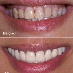 Cosmetic Dentistry in San Antonio Dr. Precious Thomson. Thousand Oaks Dental. General, Cosmetic, Restorative, Preventative, Pediatric, Family Dentistry. Dentist in San Antonio Texas 78232