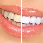 San Antonio TX Cosmetic Dentistry