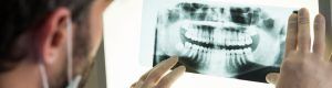 Orthodontics clear aligners braces in San Antonio thousand oaks dental dentist in san antonio