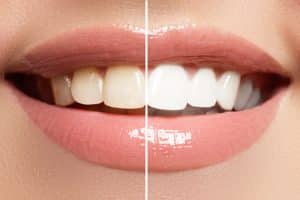  Teeth Whitening San Antonio Thousand Oaks Teeth Whitening Get Brighter, Whiter Teeth with Professional Teeth Whitening Services thousand oaks teeth whitening Dr. Precious Thomson. Thousand Oaks Dental. General, Cosmetic, Restorative, Preventative, Pediatric, Family Dentistry. Dentist in San Antonio Texas 78232